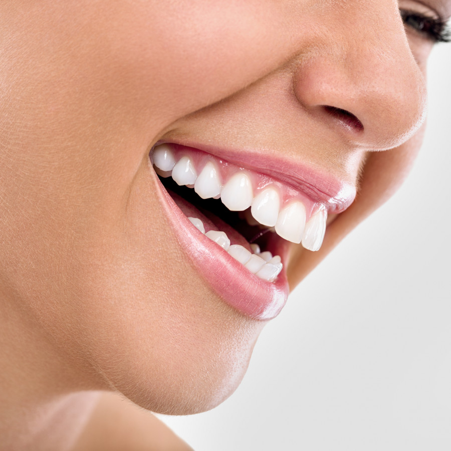 Zahnaufhellung/Bleaching