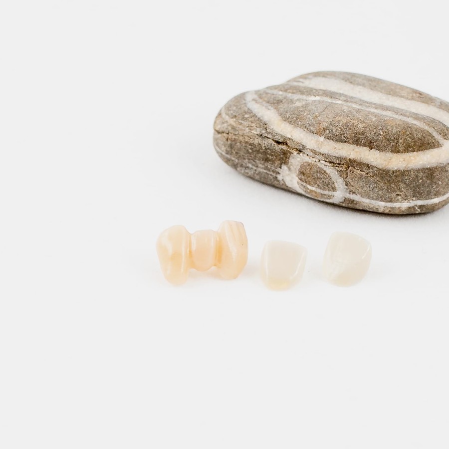 Kronen und Brücken – ganz ohne Abdruck